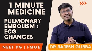 Medicine in 1 Minute : Pulmonary Embolism ECG ARDS | NEET PG  FMGE Rapid Revision By Dr Rajesh Gubba