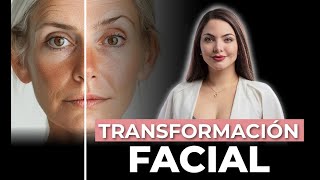 ¡En vivo! | Así realizamos una Armonización Facial en la clínica