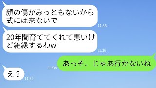 20年間育てた義理の母を顔に傷があるからと結婚式に参列させない娘「絶対来るなw」→母が要求通りに式を欠席した結果がwww