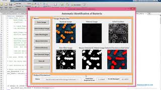 Bacteria Detection MATLAB source code