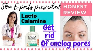 REVIEW | Lacto Calamine oil balancing face lotion | Amu Vlogilla |