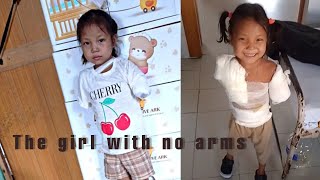 Naupang electric shock avanga ban tan sak pualin | The Girl with no arms