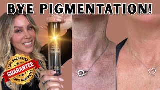 1 Ultimate Hyperpigmentation Corrector Tips Watch This For Clear Skin