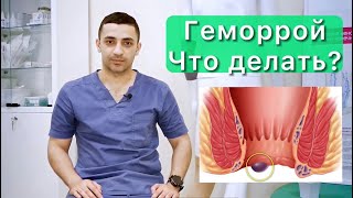 Причины геморроя, симптомы, его стадии и самые эффективные методы лечения