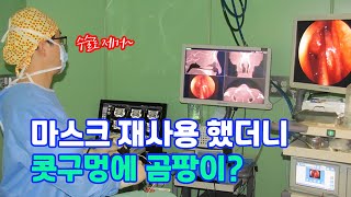 코로나19 때문에 마스크 재사용했더니 콧구멍에 곰팡이가?