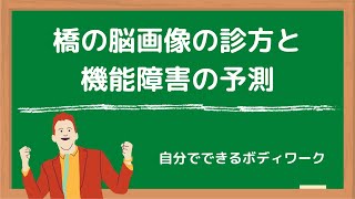 橋の脳画像の診方と機能障害の予測