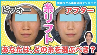 【糸リフト】どの糸で施術すべき？糸リフトの糸による違いや特徴を症例写真と共に解説