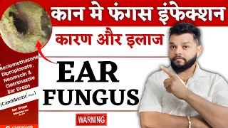 कान में दर्द,बहना,कम सुनाई देEar Fungus Infection Cases And Treatment / Eardrop For Ear wax in hindi