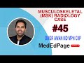 Musculoskeletal (MSK) Radiology CASE #45