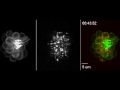 Live-imaging shows how aminoglycoside antibiotics damage hair cells