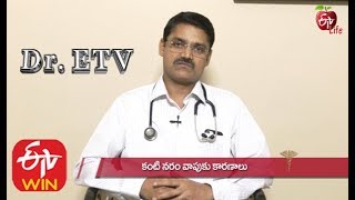 కంటి నరం వాపుకు కారణాలు | డాక్టర్ ఈటీవీ |30th నవంబర్ 2019| ఈటీవీ  లైఫ్