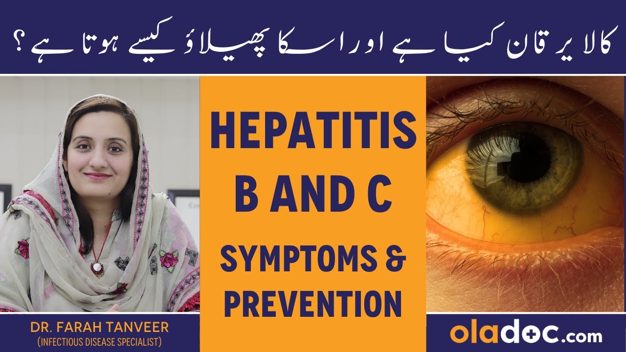 Hepatitis B And C Symptoms Prevention - Kala Yarkan Kaise Hota Hai ...