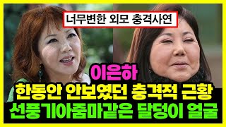 이은하 너무 변해버린 외모 충격적 근황