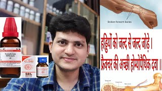 Fracture | Homeopathic medicine for Fracture ?? हड्डियों को जल्दी से जोड़ने की होम्योपैथिक दवा | #