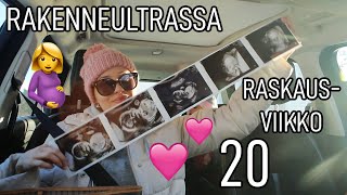 RAKENNEULTRA 🤰🏻 (myday)