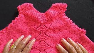 Knitting Baby Frock / Tunic (Part-2)