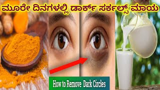 ಕೇವಲ ಎರಡೇ ಪದಾರ್ಥಗಳಿಂದ  ಡಾರ್ಕ್ ಸರ್ಕಲ್ಸ್ ಮಾಯ | How to remove dark circles in Kannada | C Beauty Care |