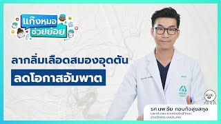 เเก๊งหมอช่วยย่อย EP.4 - ลากลิ่มเลือดสมองอุดตัน ลดโอกาสอัมพาต l โรงพยาบาลนครธน