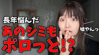 【削除覚悟】濃いシミもポロっと取れると広告される化粧品の実態とは!?