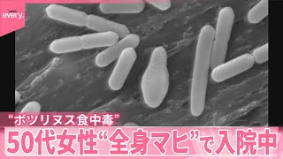 【ボツリヌス菌による食中毒】50代女性が全身マヒの症状で入院中  “密封”の総菜を約2か月常温保管