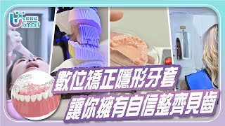 【優智能 隱形牙套篇】如何讓美麗與自信悄悄跟著你 #隱形牙套 #隱形矯正