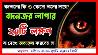 বদ নজর লাগার ২০টি এমন লক্ষণ ও আলামত যা দেখলেই বুঝে নিবেন যে আপনাকে বদনজর লেগে গিয়েছে। evil eye |