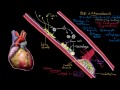 Atherosclerosis  Circulatory System and Disease  NCLEX-RN  Khan Academy