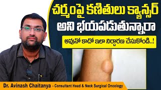 క్యాన్సర్ కణితిని గుర్తించండి ఇలా | How to Identify Cancer Tumor in Telugu | Kaizen Oncology Network