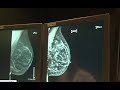 Women's Health Week: Everything you need to know about breast health