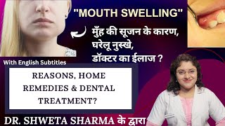 Swelling In Mouth| मुँह की सूजन को कैसे कम करें? कारण, घरेलू उपचार और डॉ° का ईलाज