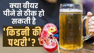 Kidney Stone Beer: Can beer be useful in the treatment of stones, know from experts! , Myth Or Facts