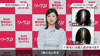 第23回発毛日本一コンテスト入賞 小川様(31歳女性)