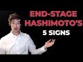 5 Signs of End Stage Hashimoto's