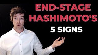 5 Signs of End Stage Hashimoto's