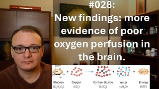 028 - New findings: more evidence of poor oxygen perfusion in the brain.