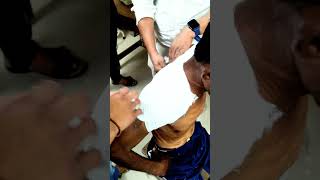 Collar Bone  Fracture 😳🥺? #ytshorts #feed #feedshorts #viralvideo #trending