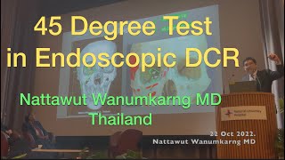 45 Degree Test  in Endoscopic DCR