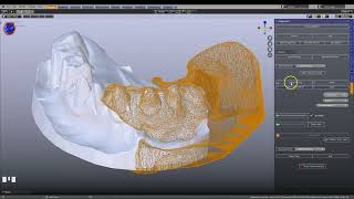 【B4D】Blenderfordental中配准对齐工具｜Dental Forever