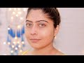 How to Remove Hyperpigmentation at Home | Rinkal Parekh