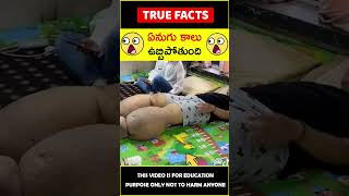 Rare disease explained in telugu #factsintelugu 😱ఏనుగు కాలు😱 #amazingfacts #truefacts #shorts