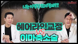 평생 컴플렉스 운동장보다 넓은 이마 [헤어라인교정 VS 이마축소술 ] 나는 어떤걸 해야할지 모를때!!!!