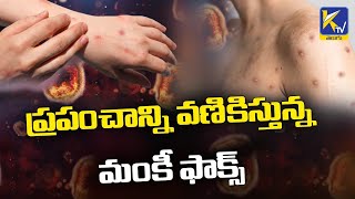 తెలంగాణలో కొత్త వైరస్ కలకలం | Monkeypox declared 'Global Health Emergency' | Ktv Telugu News