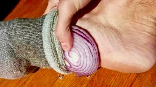 THIS Happens When You Put Onions In Your Socks While You Sleep