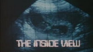 The inside view (1979)