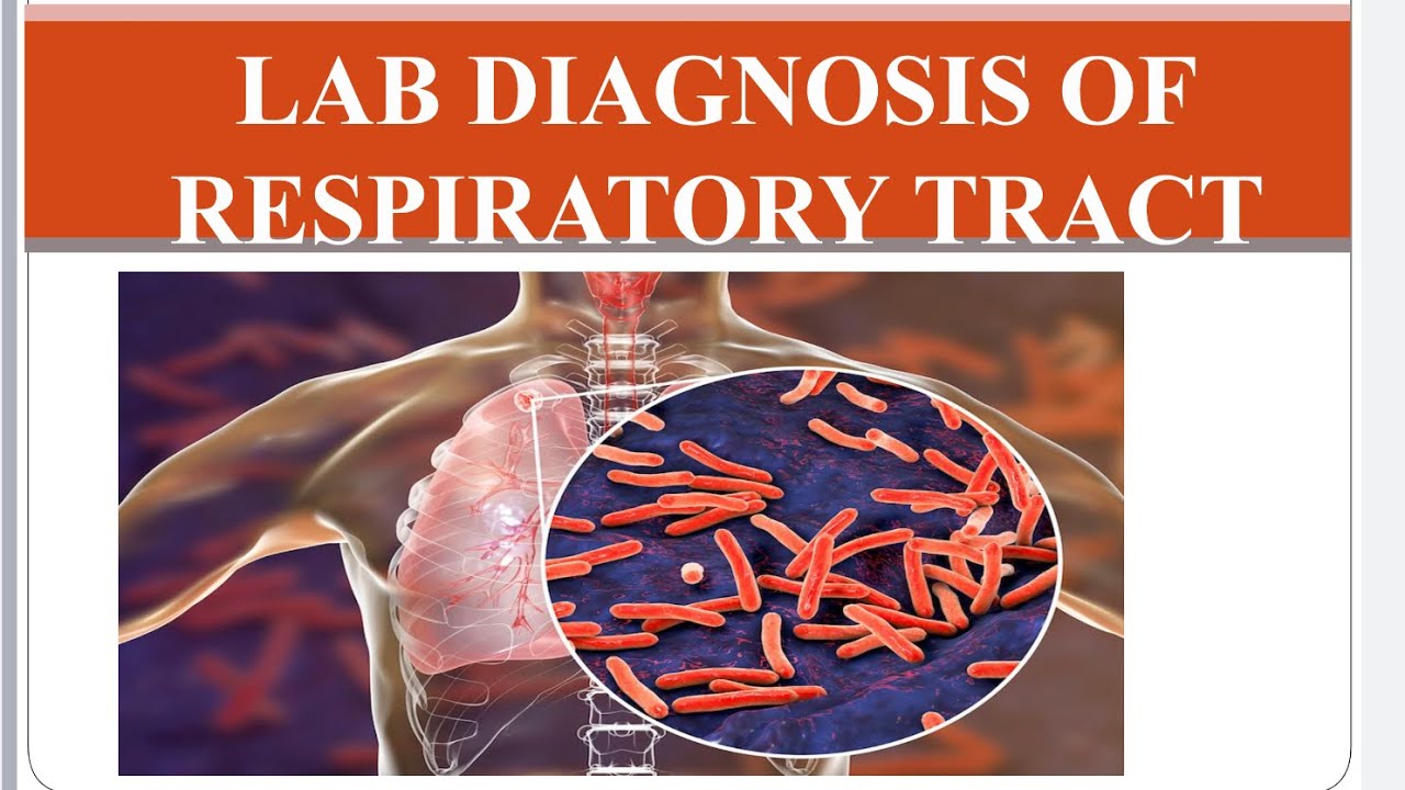 Lab Diagnosis Of Respiratory Tract Infection #Microbiology #medical ...