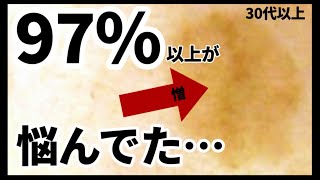 ドラックストアでシミ対策できるスキンケアをプロが本気で選ぶ【アンケート結果も】