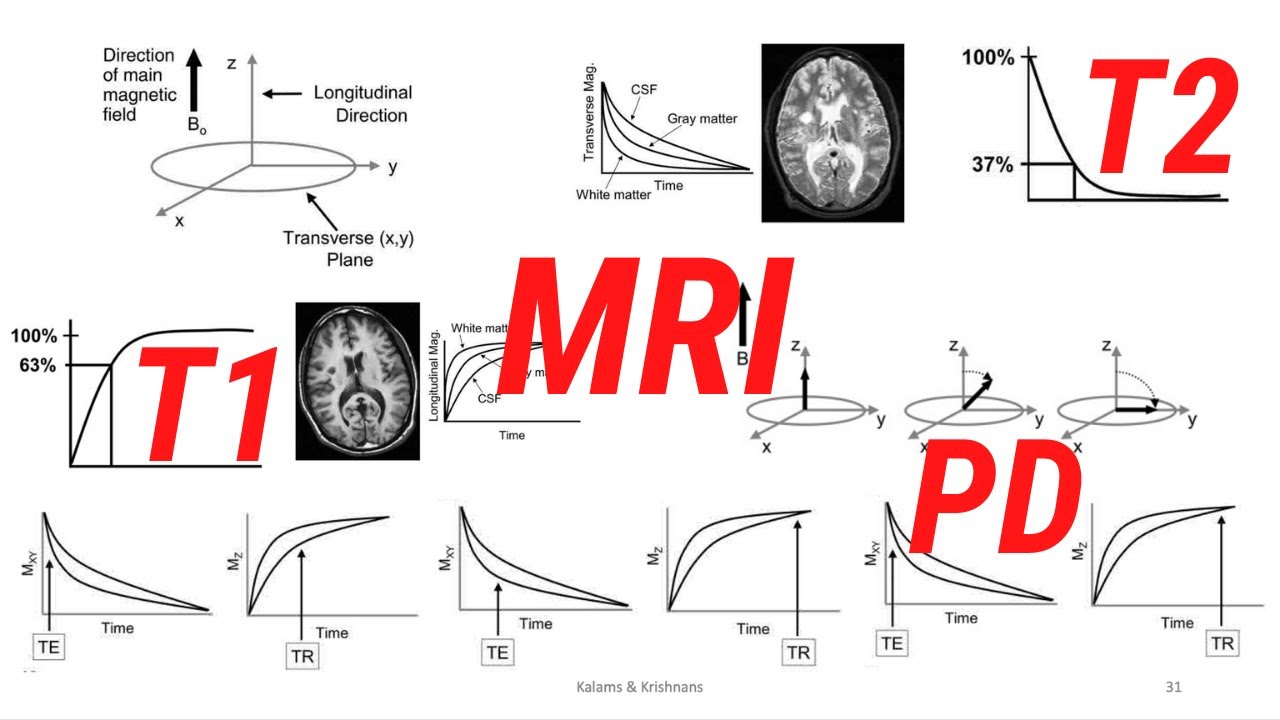 MRI Contrast Mechanisms T1 T2 PD Weighing - YouTube