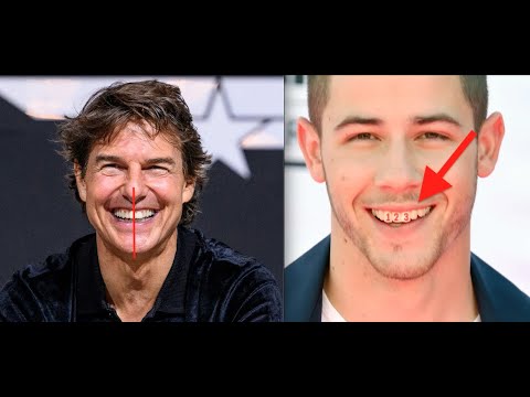 Are Nick Jonas teeth crooked?