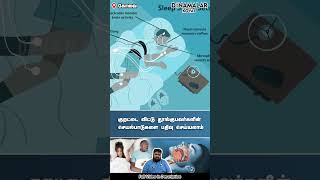 குறட்டை விட்டு துாங்குபவர்களின் செயல்பாடுகளை பதிவு செய்யலாம்