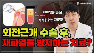 어깨 회전근개파열 수술 후 재파열을 낮춰주는 이 치료법